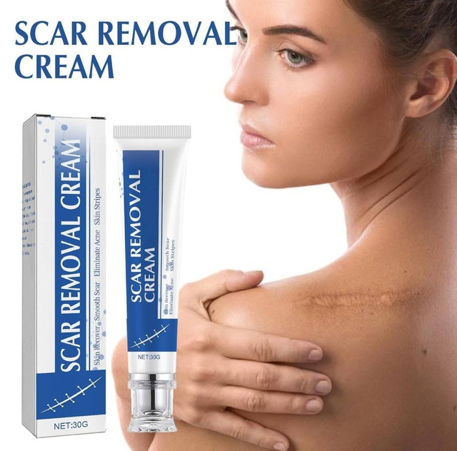 Plastic Scar Removal Cream (White-Blue) - Image 3
